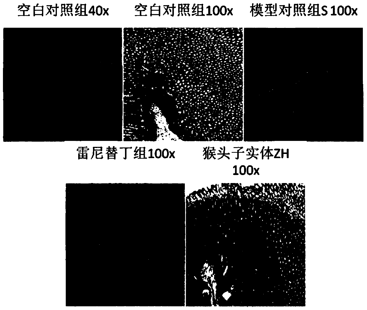 Hericium erinaceus tableting candy, and preparation method and application thereof