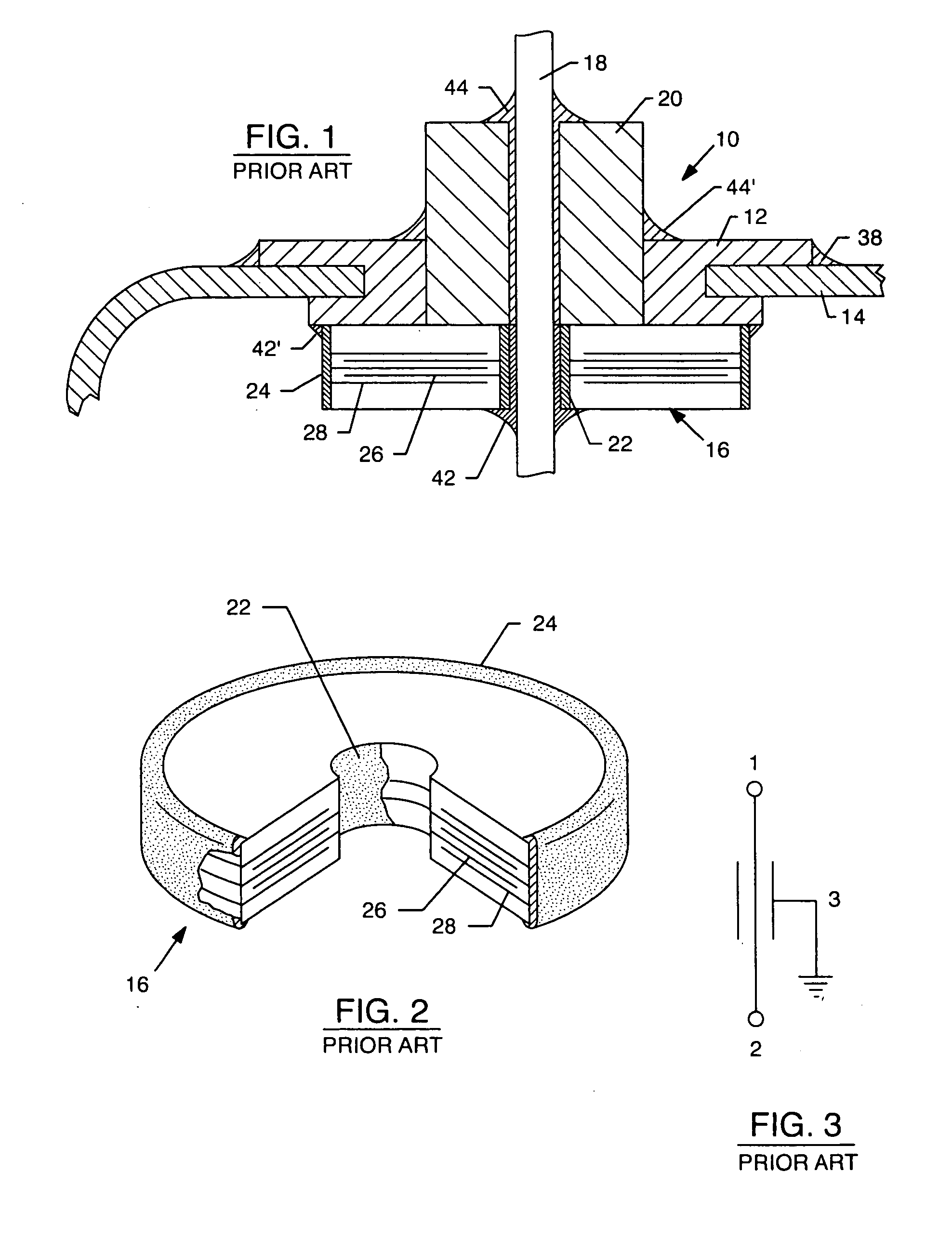 Inductor capacitor EMI filter for human implant applications