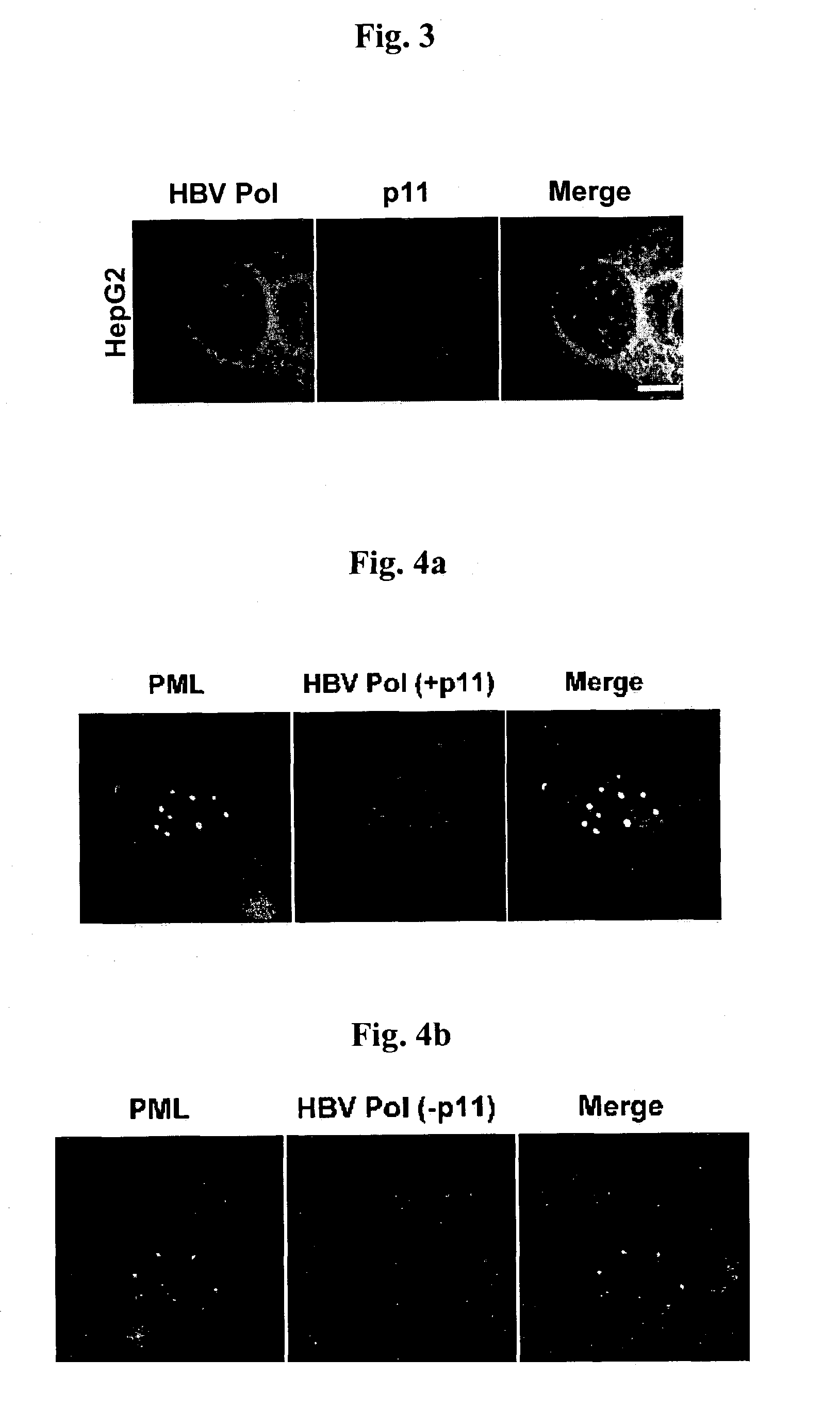 Complex of Hepatitis B virus polymerase with p11 and method for controlling movement of the complex in HepG2 cell