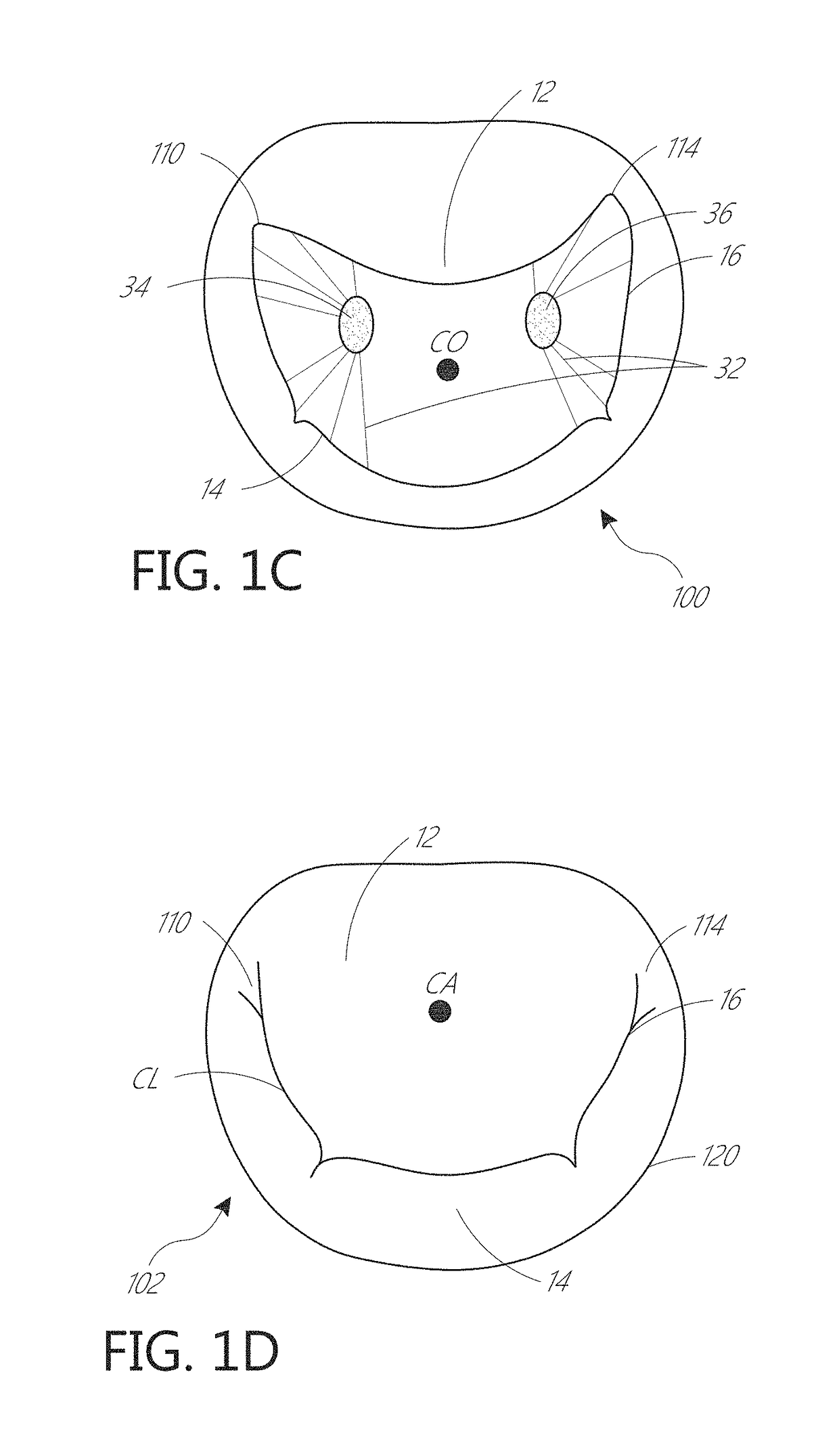 Device, system, and method for transcatheter treatment of valvular regurgitation