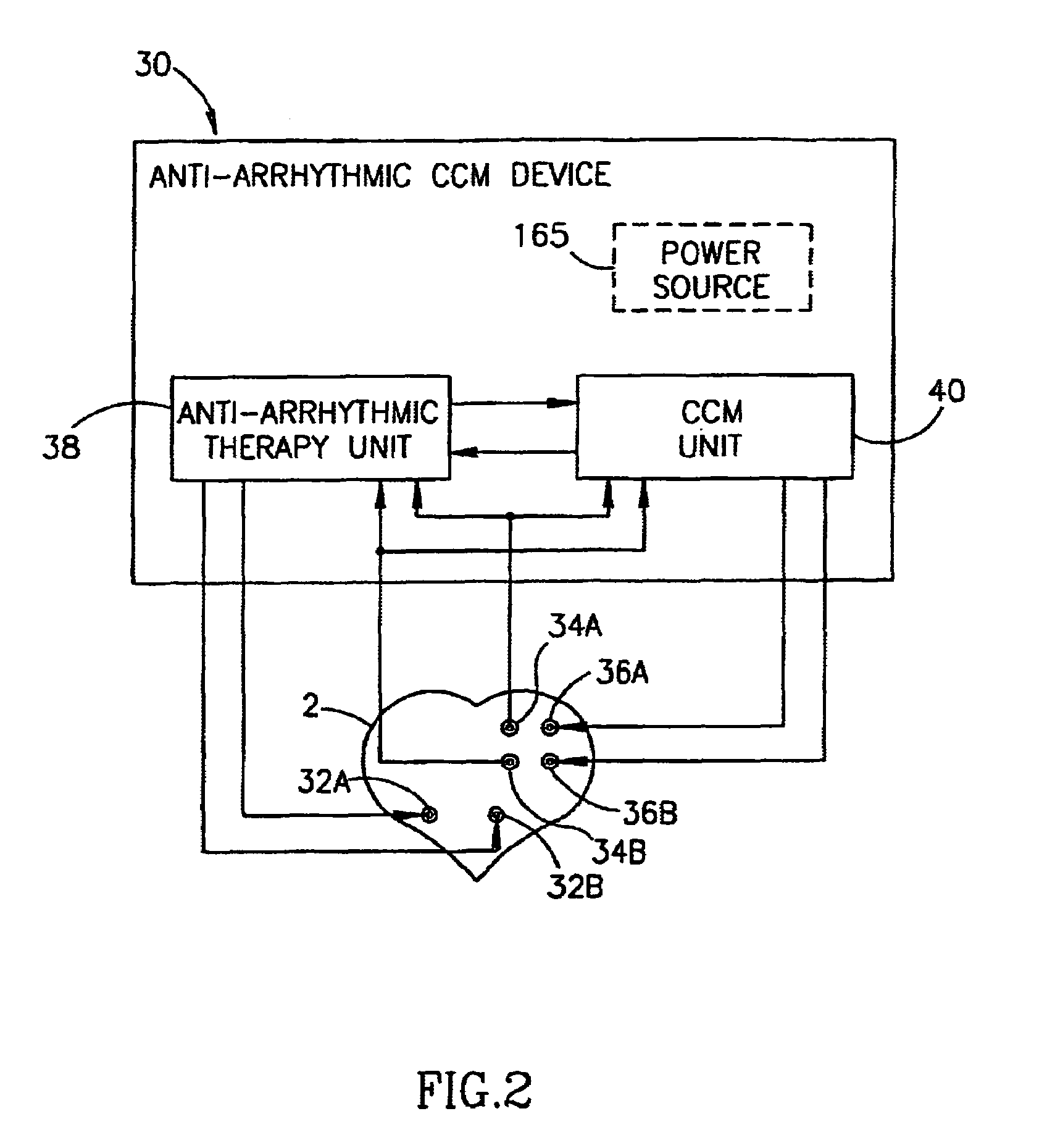 Device for cardiac therapy