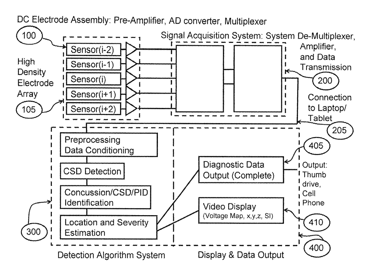 Non-invasive systems and methods to detect cortical spreading depression for the detection and assessment of brain injury and concussion