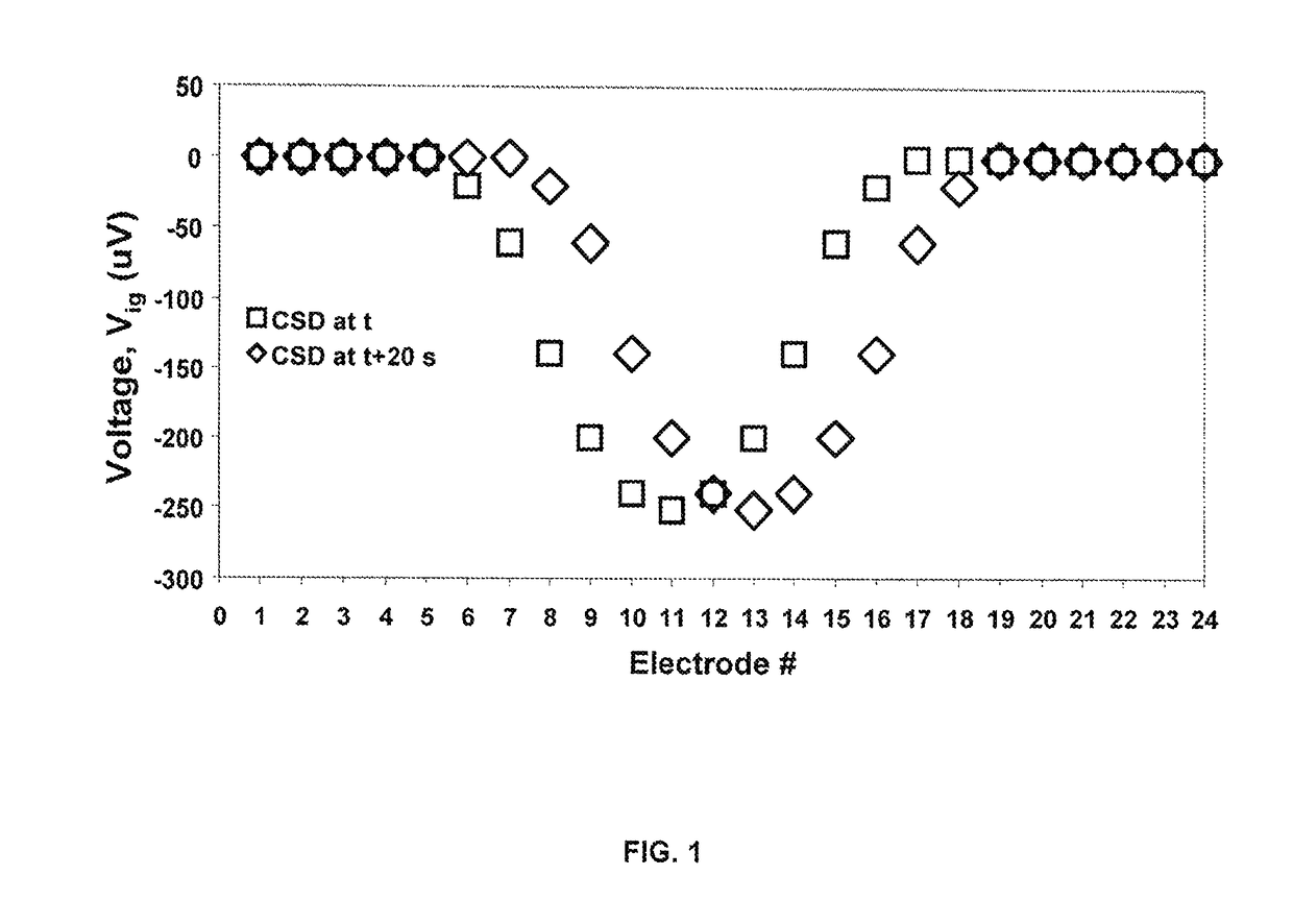 Non-invasive systems and methods to detect cortical spreading depression for the detection and assessment of brain injury and concussion