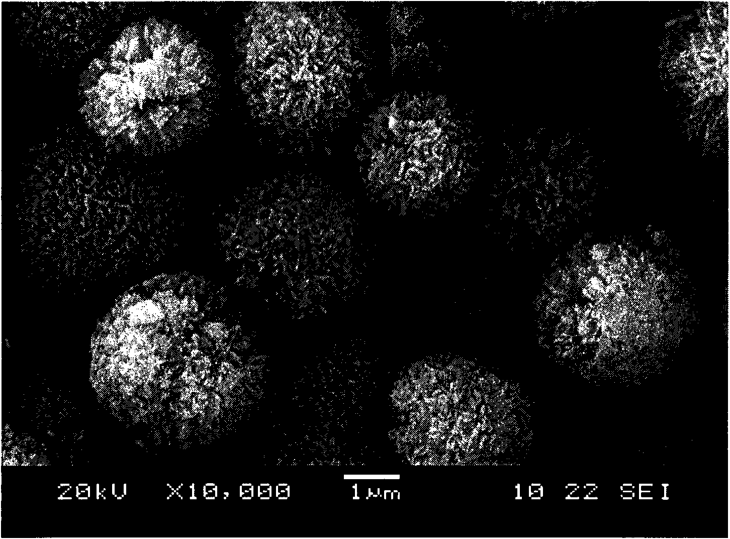 Spherical and radial magnesium carbonate and preparation method thereof