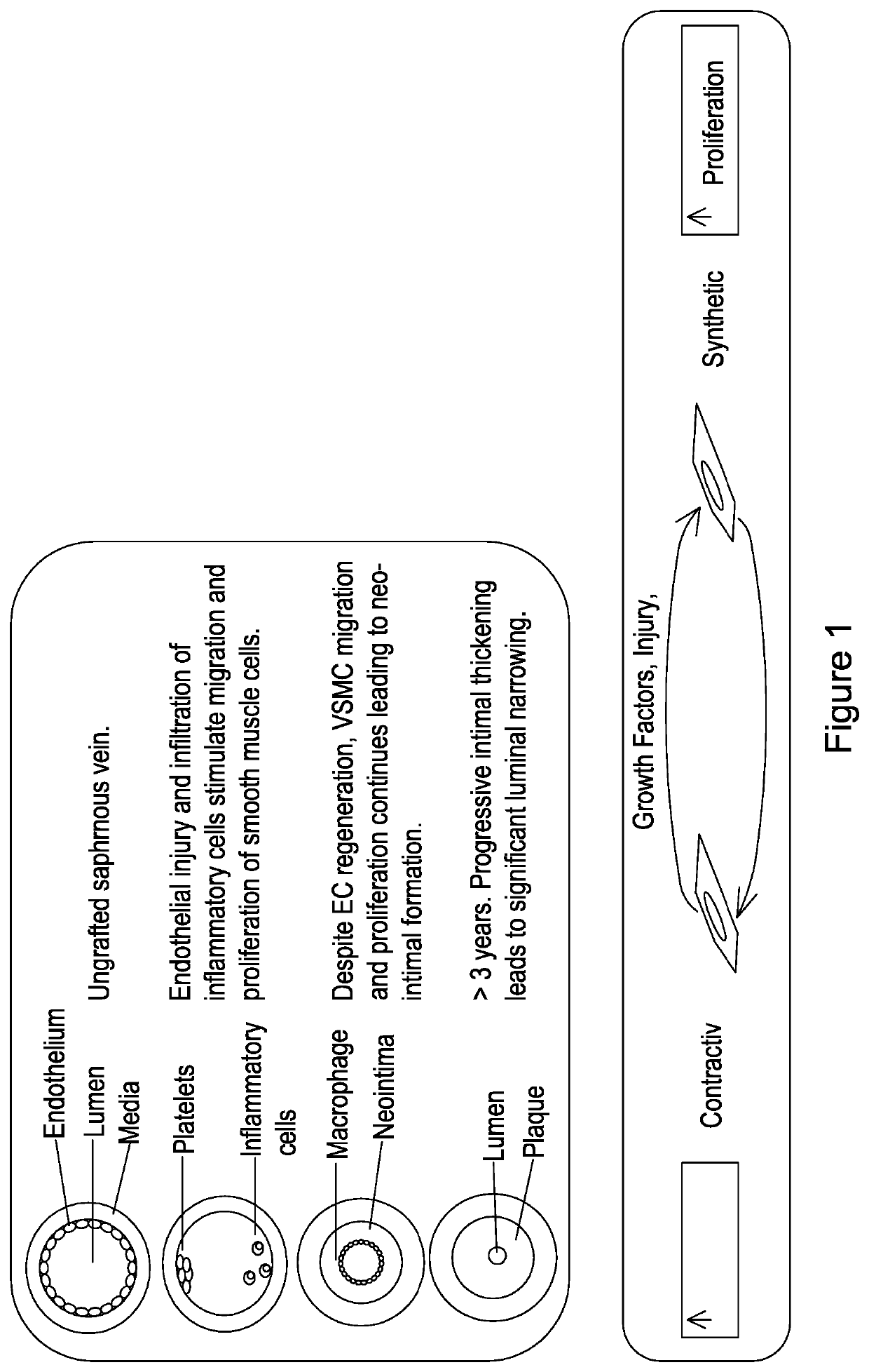 Materials and methods for the treatment of vascular disease