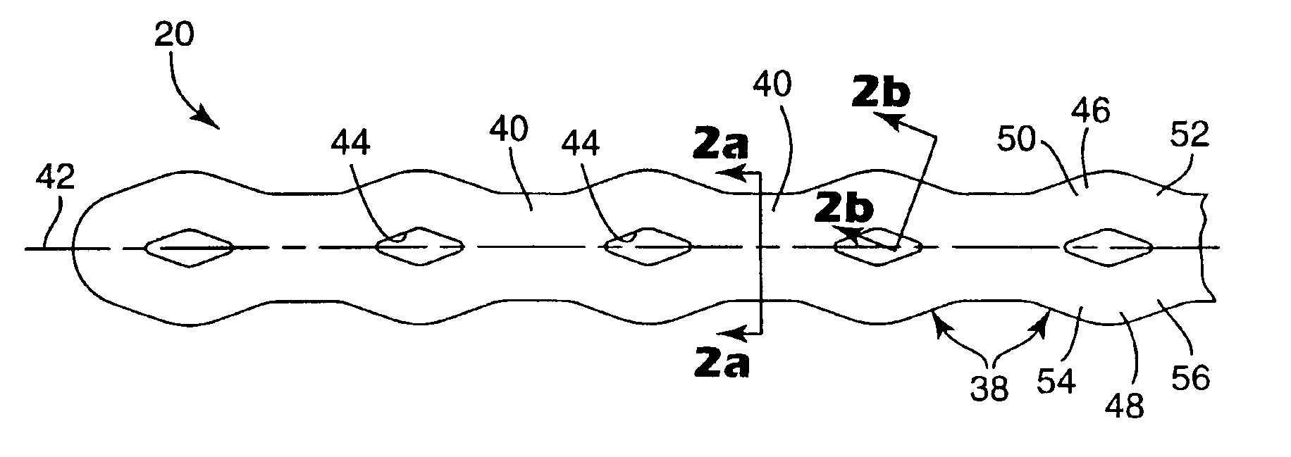 Elastomeric force module for orthodontic treatment