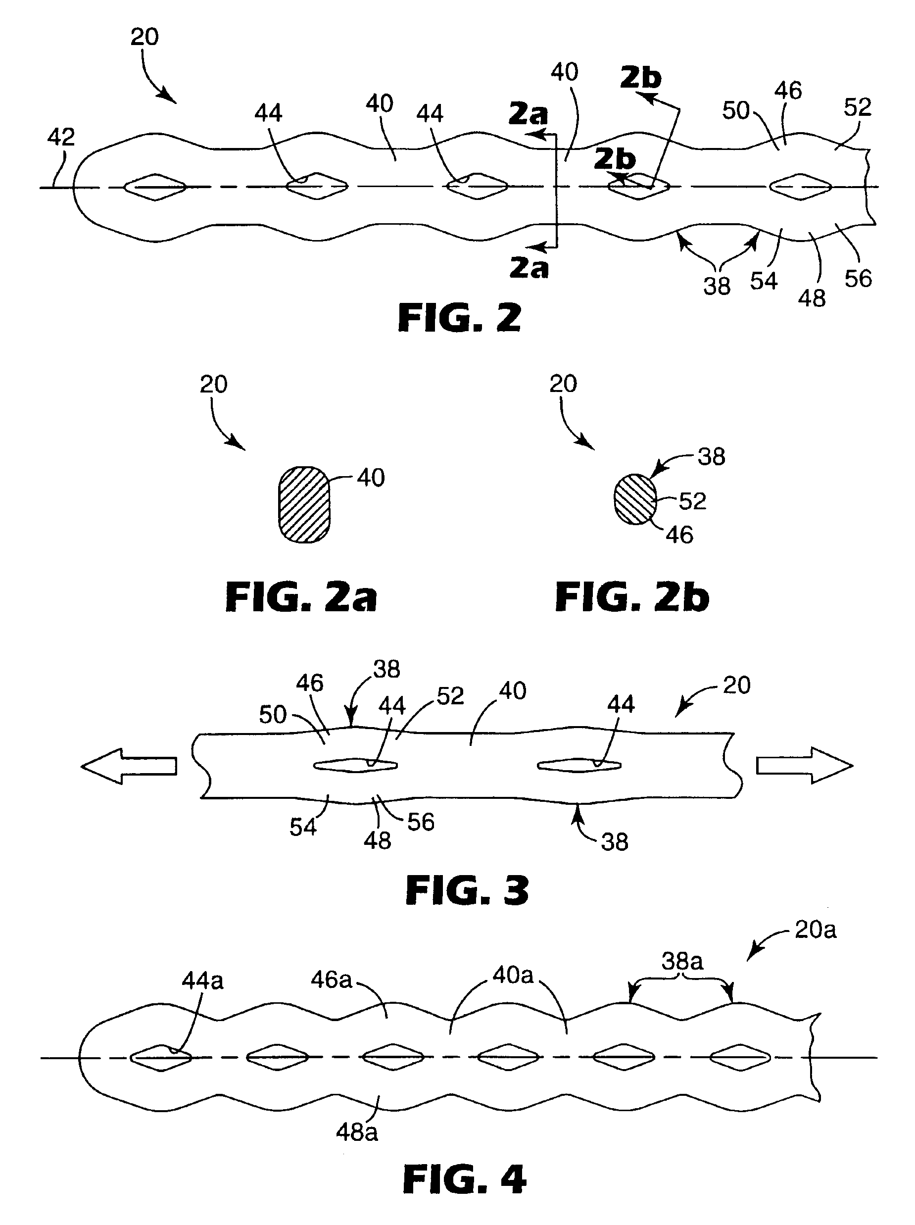 Elastomeric force module for orthodontic treatment