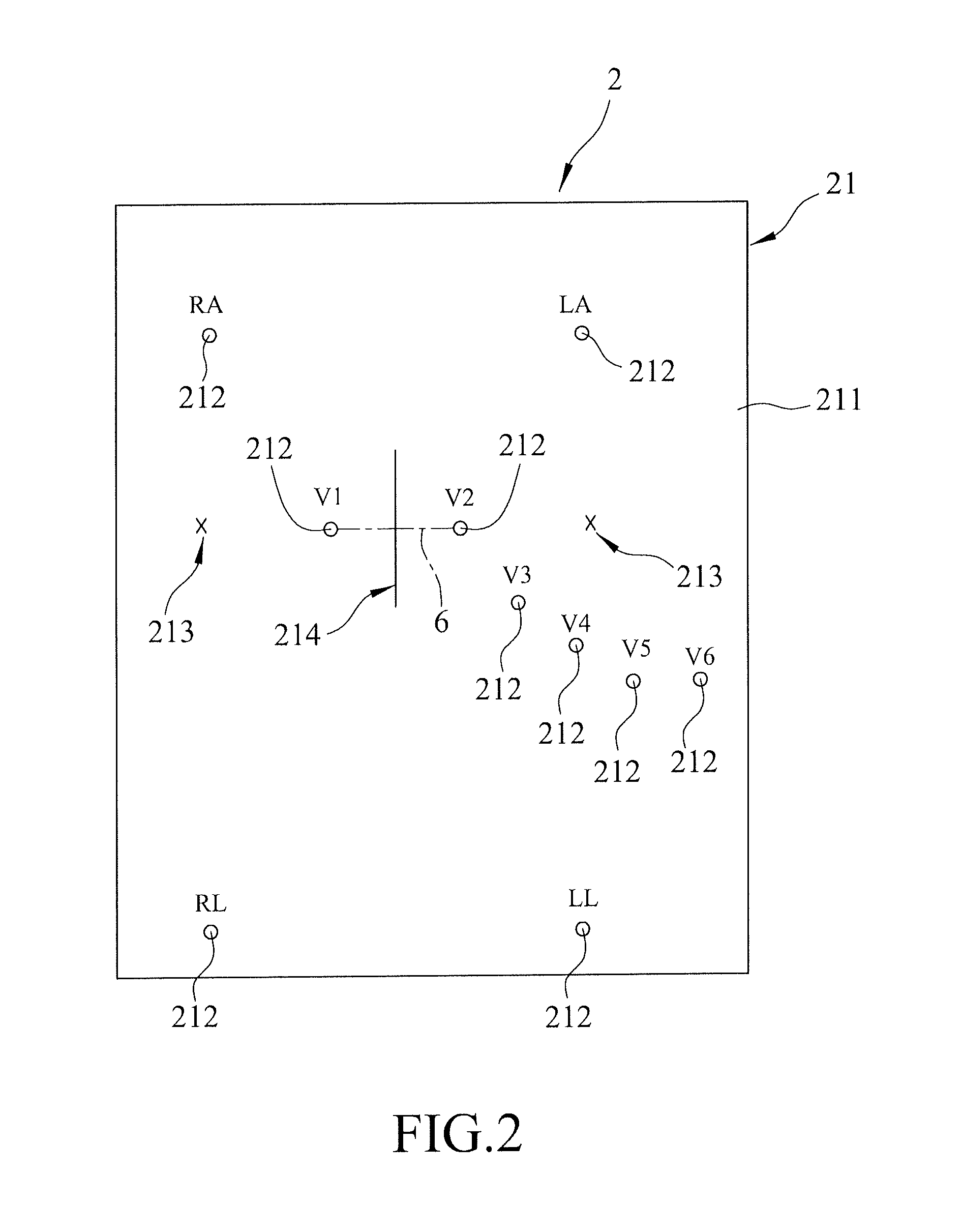 Accessory device for twelve-lead electrocardiography apparatus