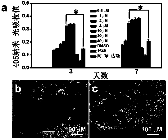 Anacardic acid as an inhibitor of glyceraldehyde triphosphate dehydrogenase in echinococcosis and as a drug for echinococcosis