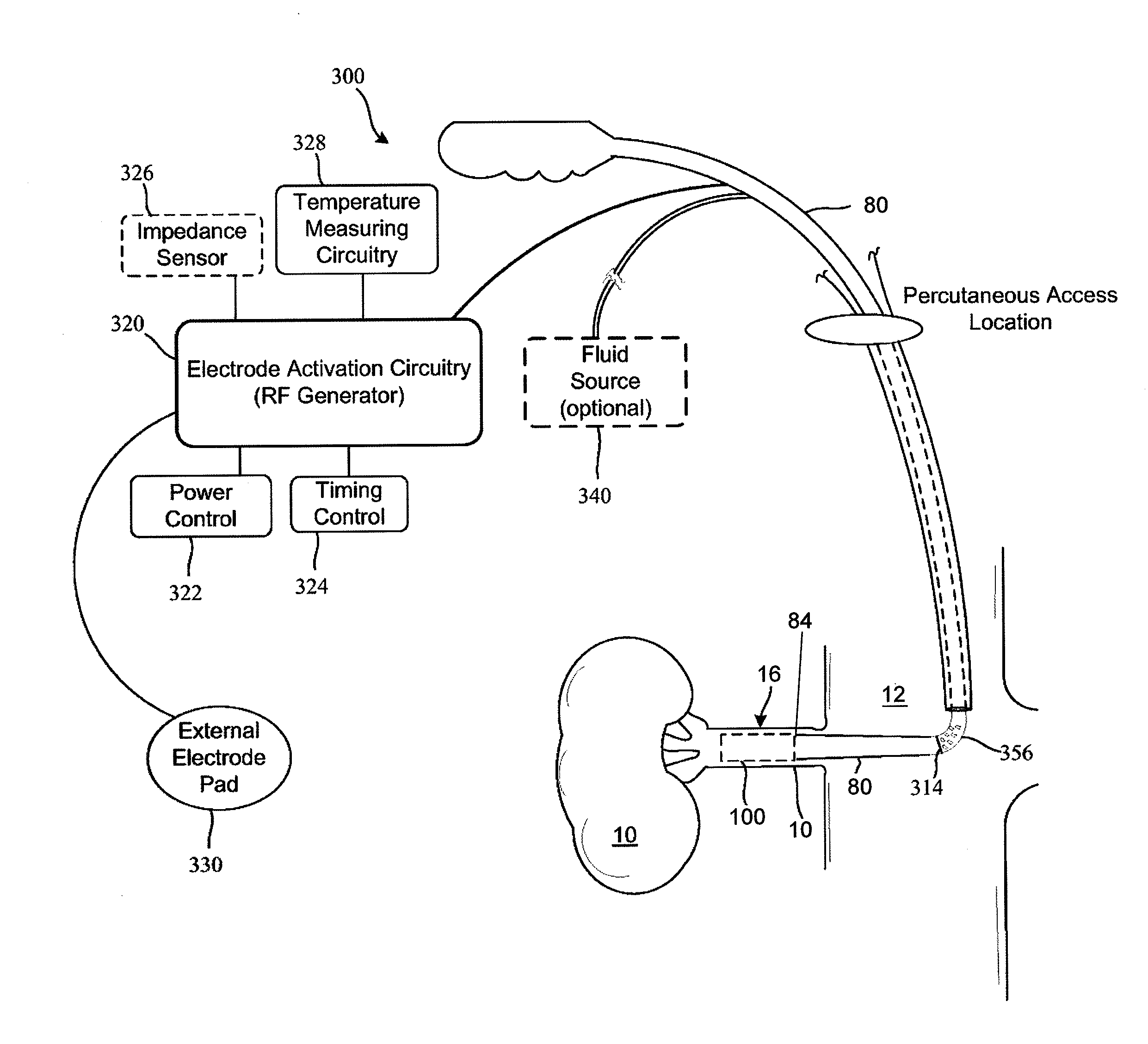 Tissue treatment device and related methods