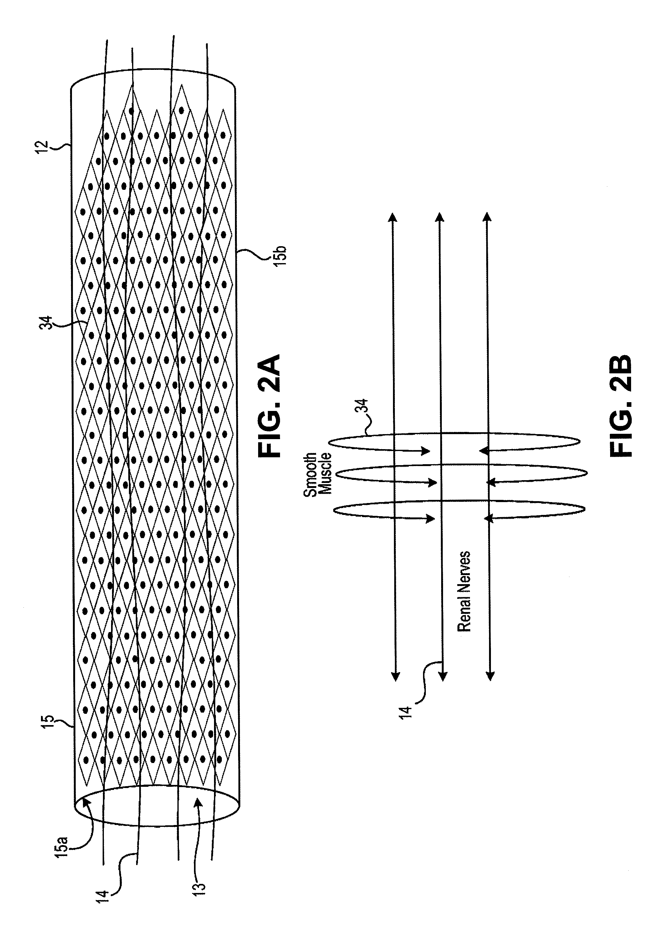 Tissue treatment device and related methods