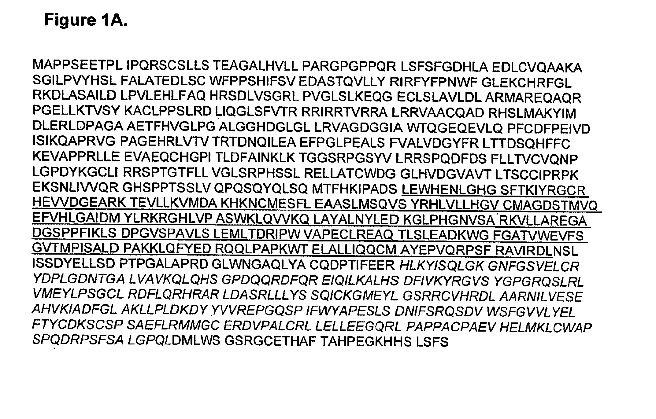 Mutant jak3 kinase in human leukemia