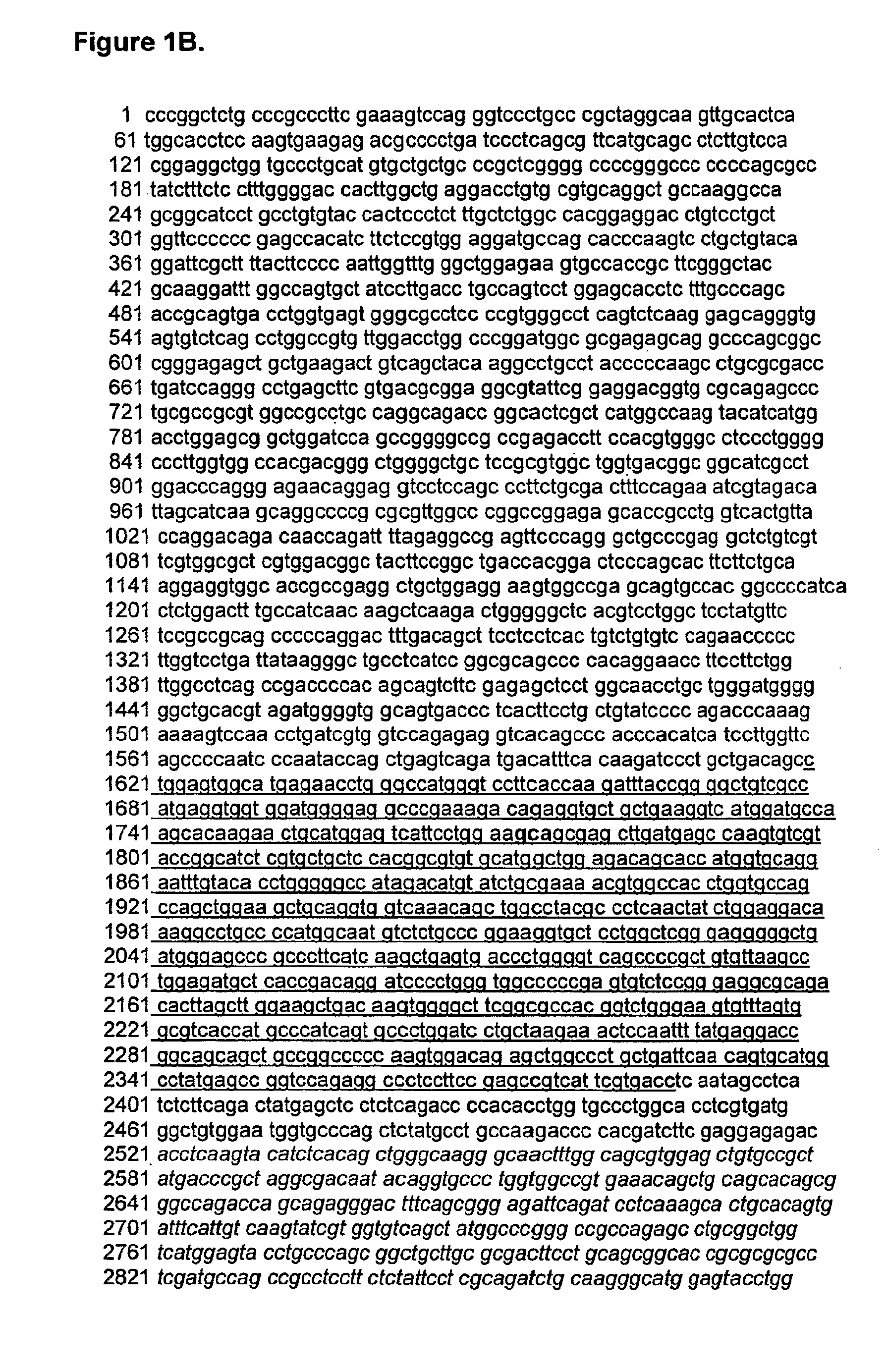 Mutant jak3 kinase in human leukemia