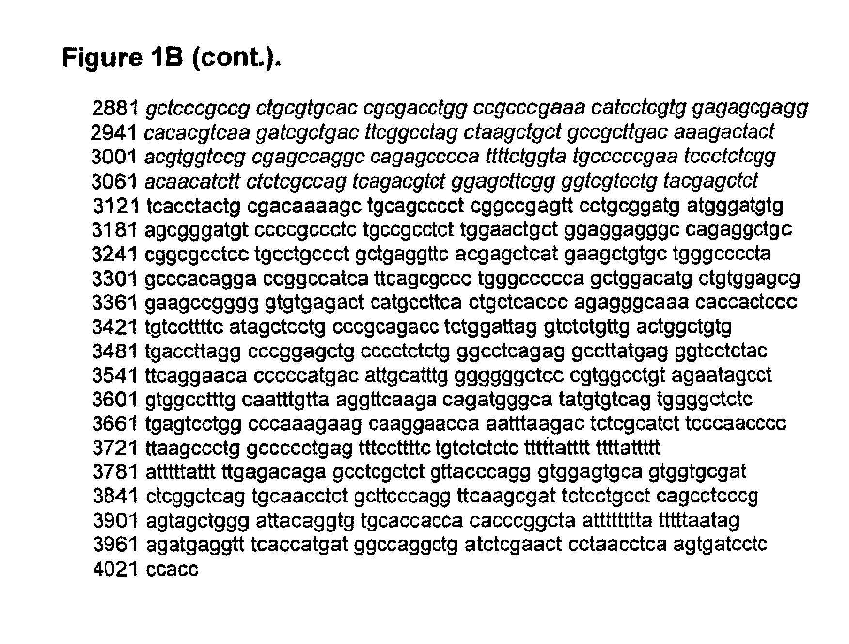 Mutant jak3 kinase in human leukemia