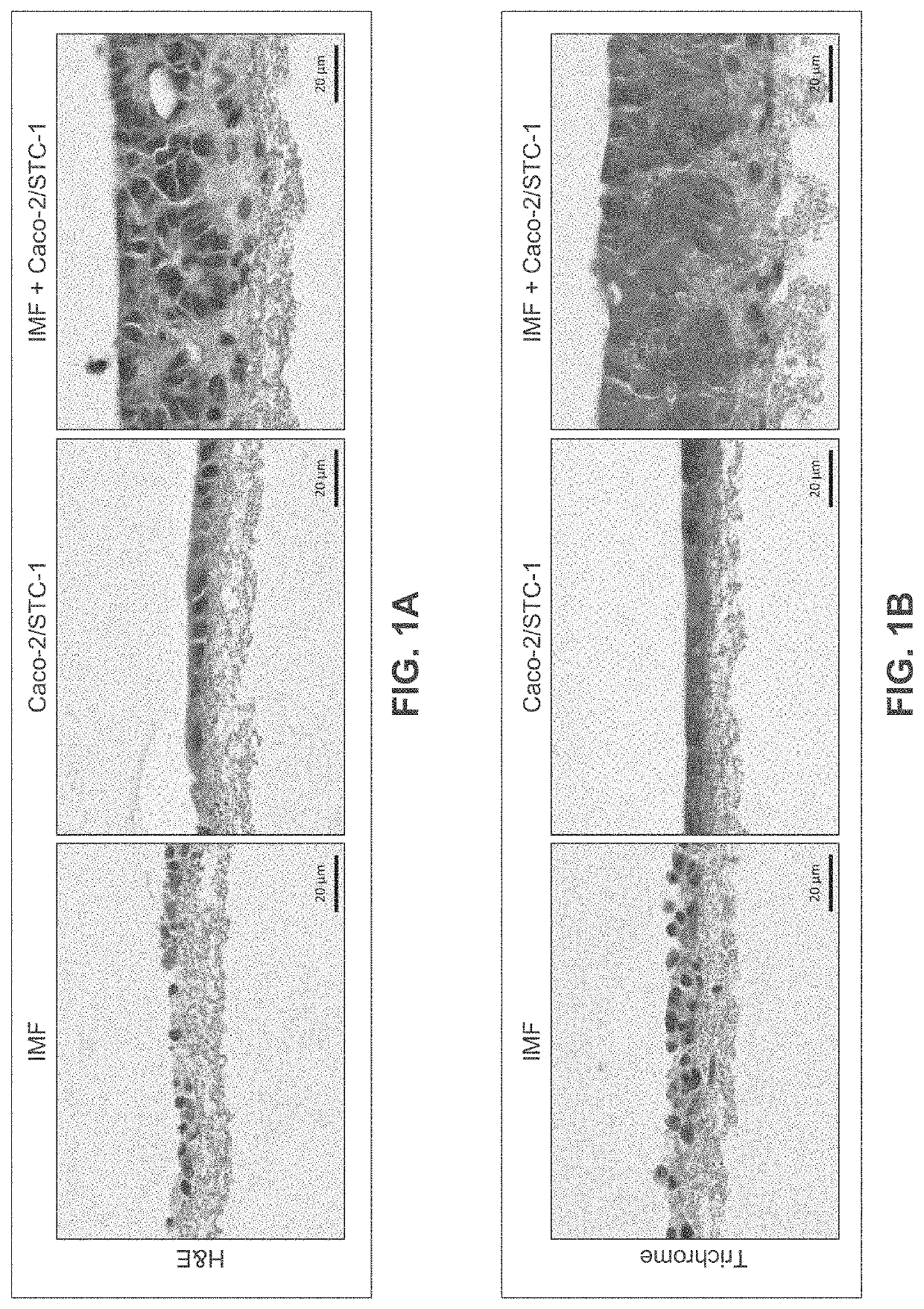 Engineered Intestinal Tissue and Uses Thereof