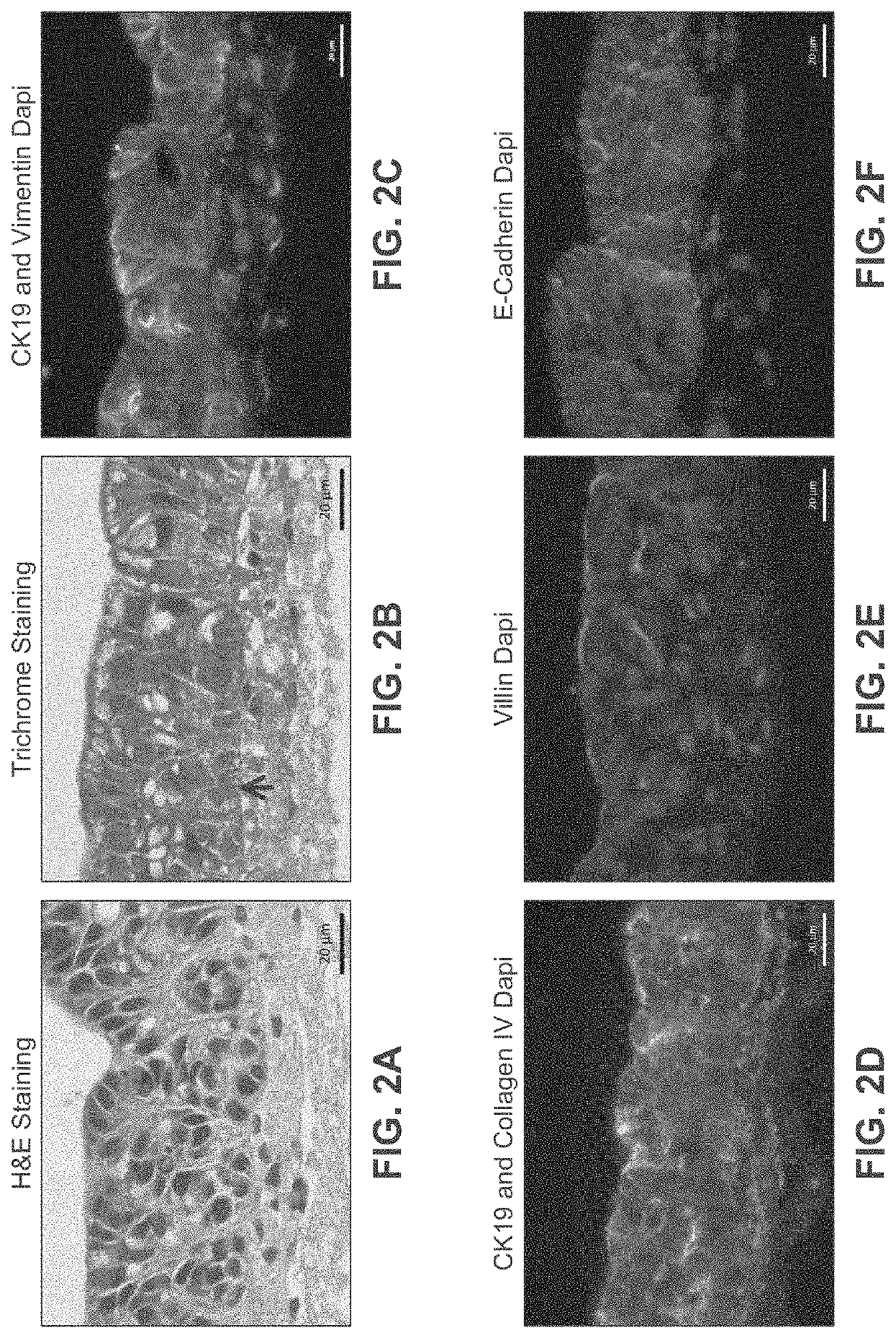 Engineered Intestinal Tissue and Uses Thereof