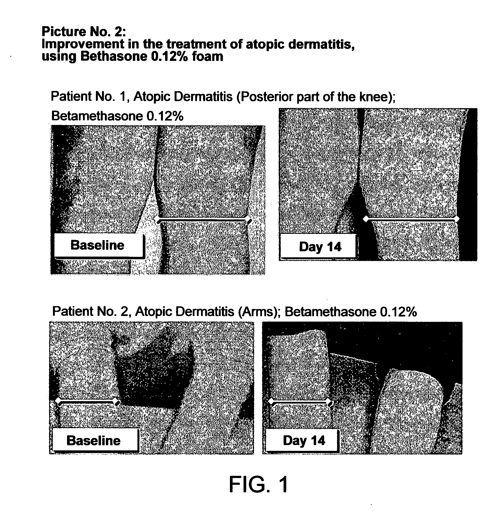 Cosmetic and pharmaceutical foam