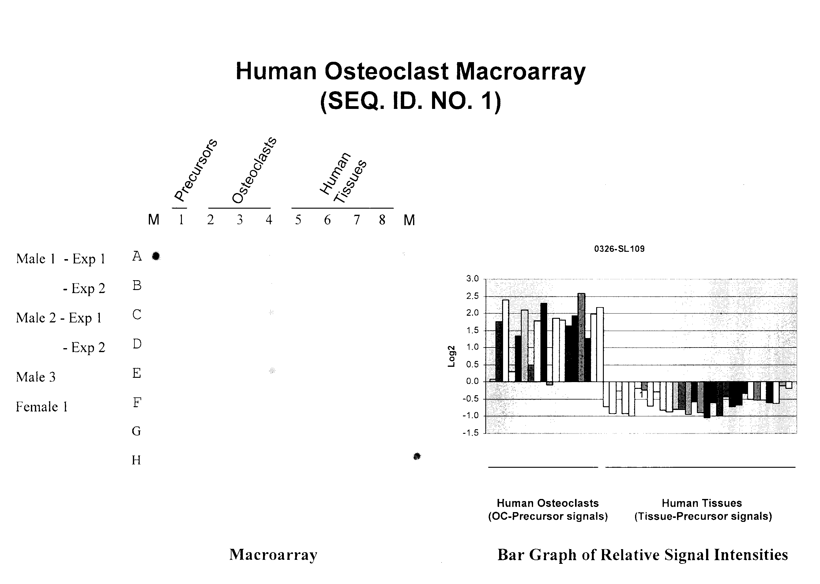 Polynucleotides and polypeptide sequences involved in the process of bone remodeling