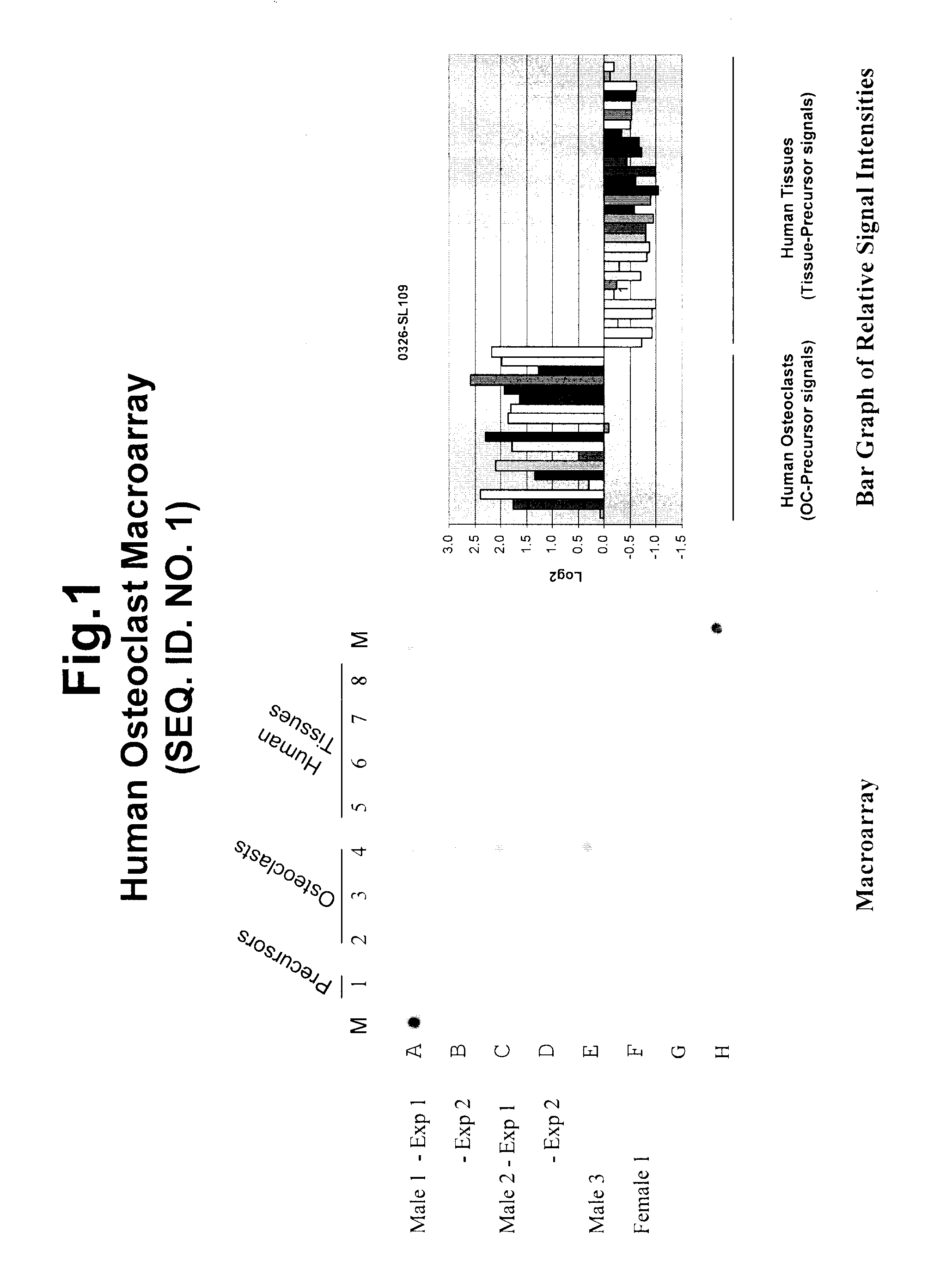 Polynucleotides and polypeptide sequences involved in the process of bone remodeling