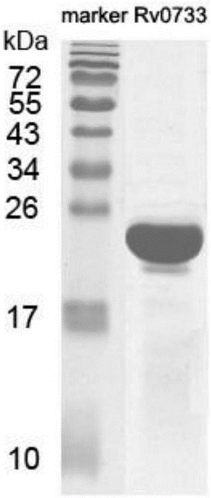 A kind of reagent for detecting specific immune response of Mycobacterium tuberculosis and use thereof