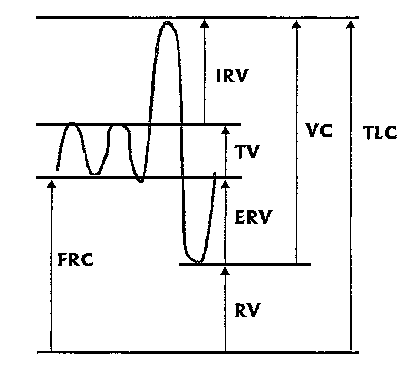 Method and apparatus for measuring functional residual capacity (FRC) and cardiac output(CO)