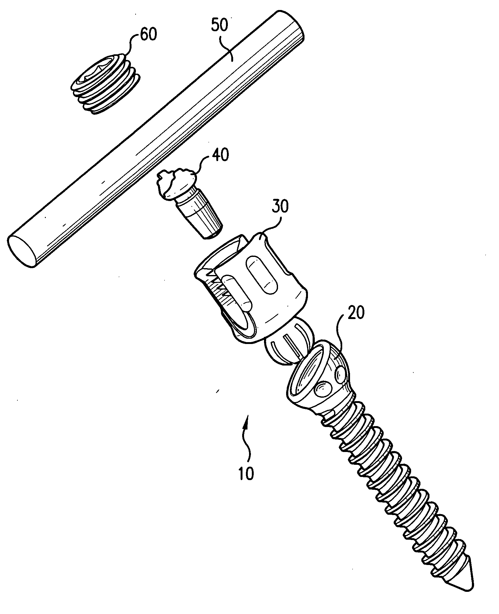 Biased angle polyaxial pedicle screw assembly