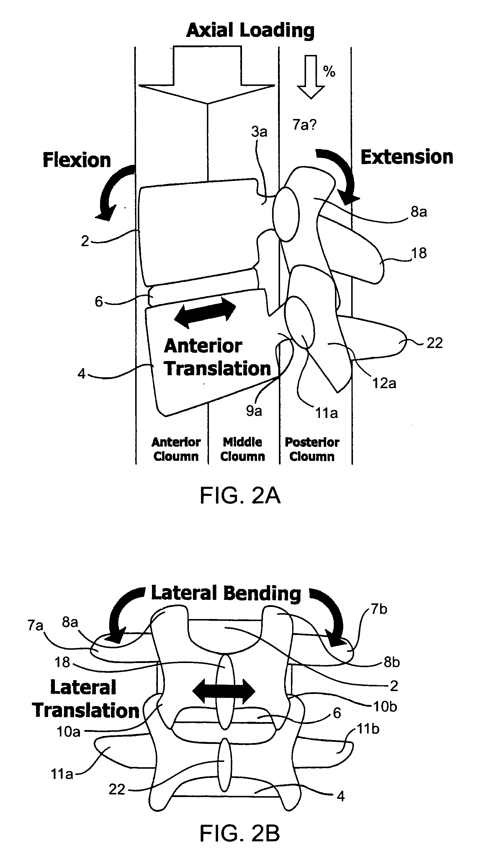 Systems and methods for posterior dynamic stabilization of the spine