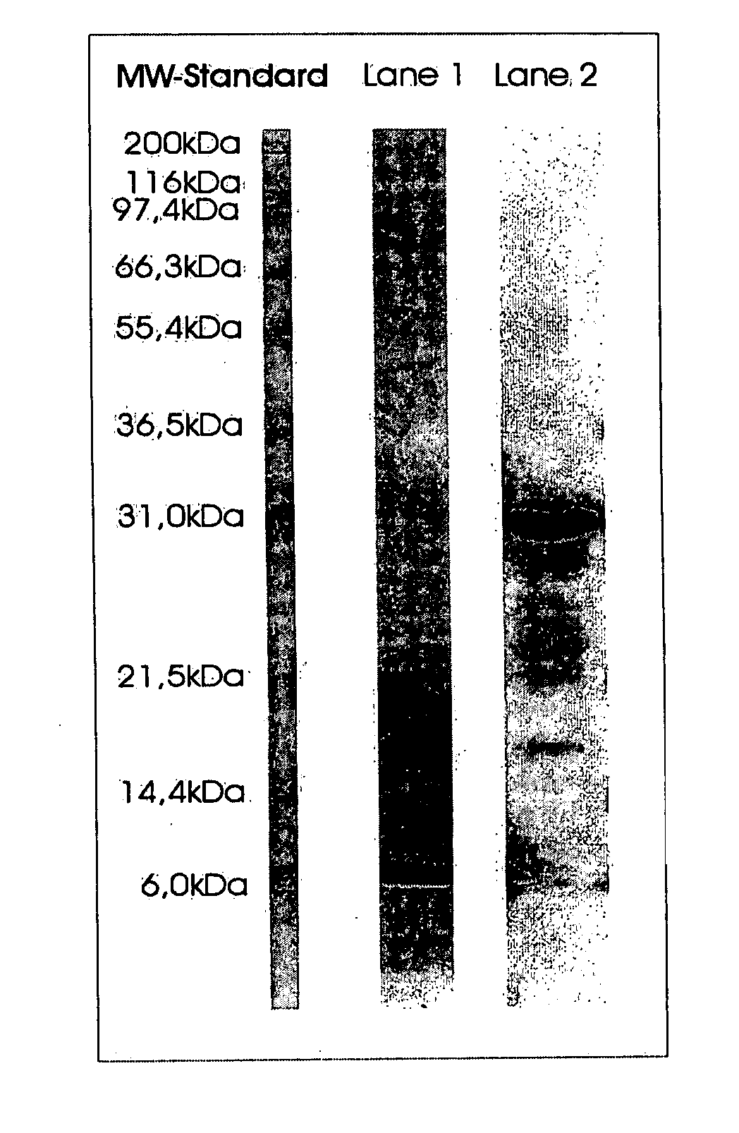 Method of isolation and purification of trypsin from pronase protease and use thereof