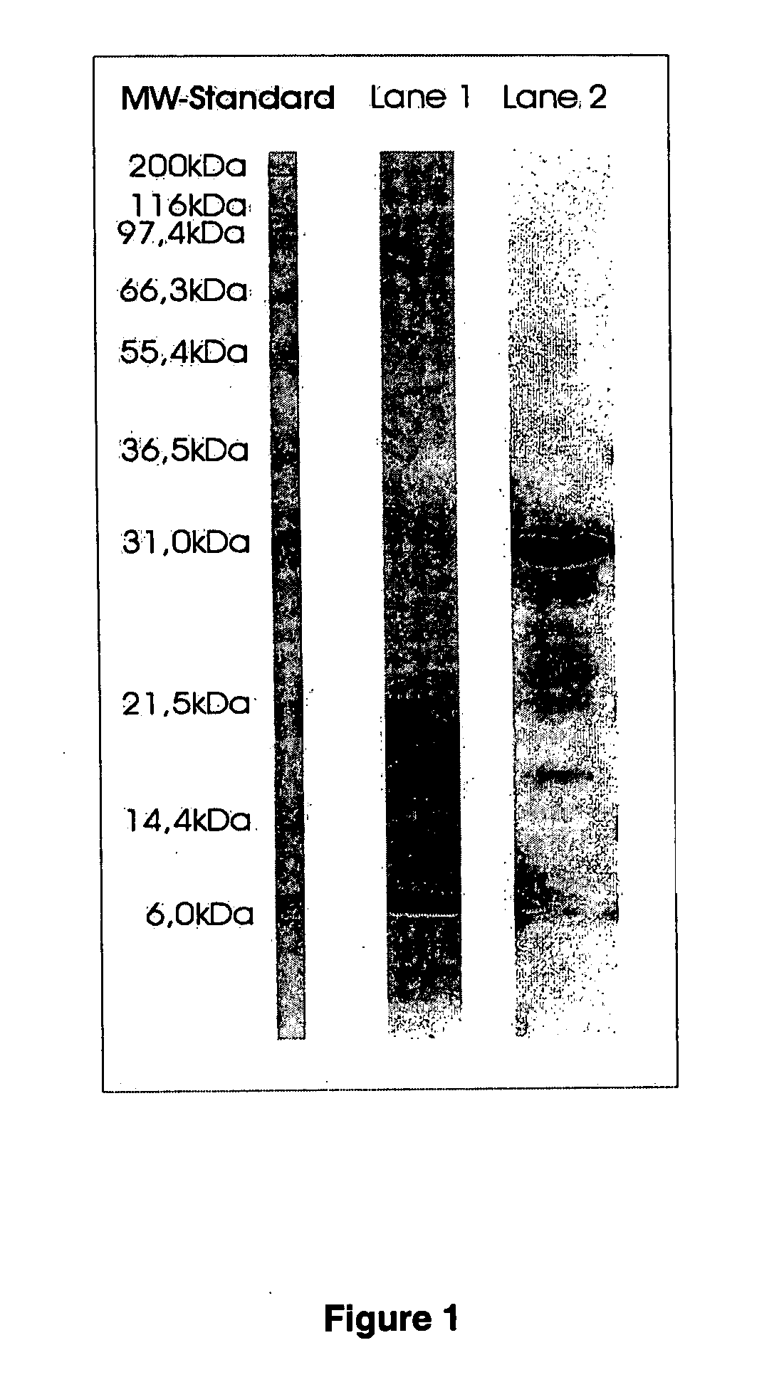 Method of isolation and purification of trypsin from pronase protease and use thereof