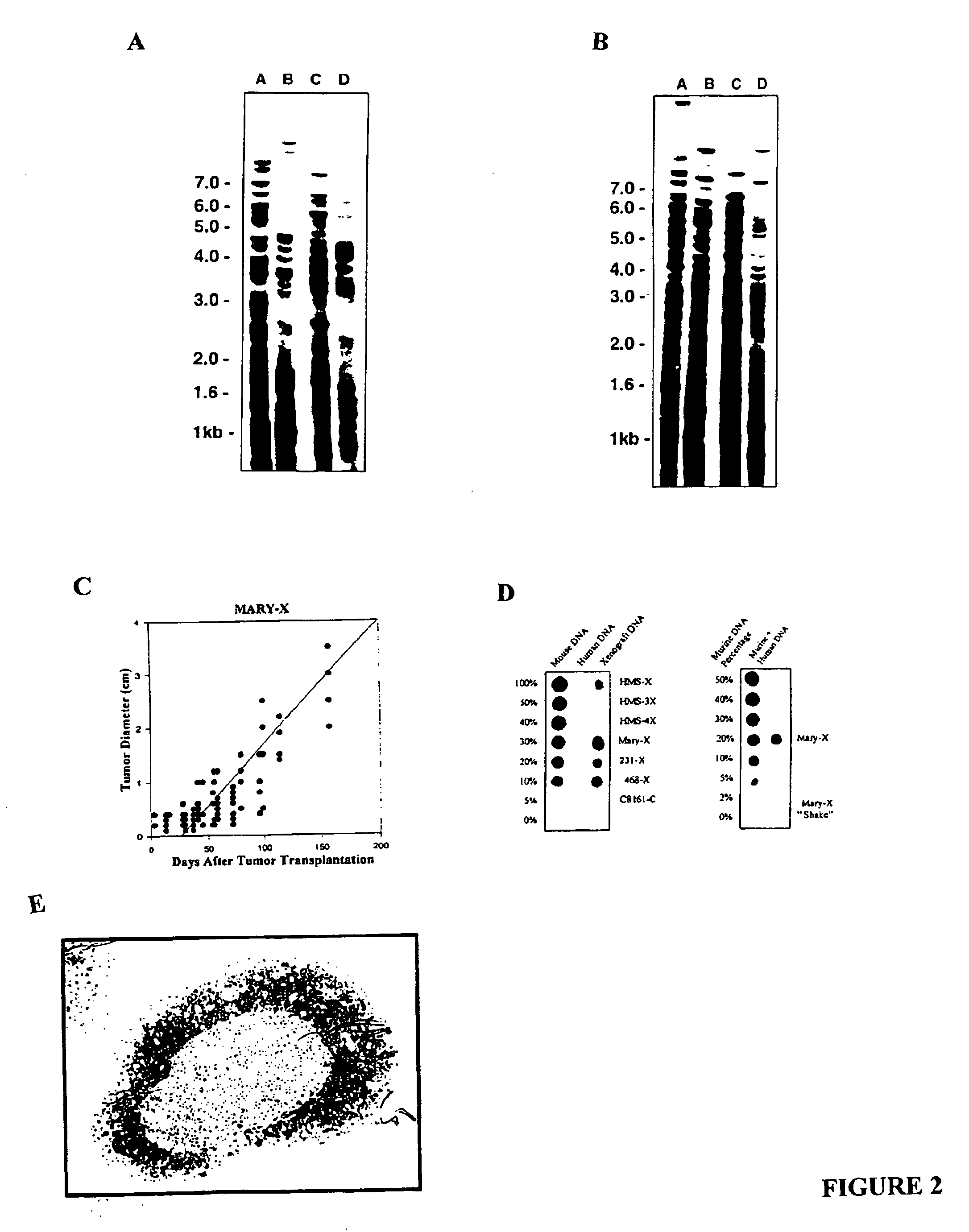 Human inflammatory breast carcinoma xenograft capable of lymphovascular invasion and methods for its use