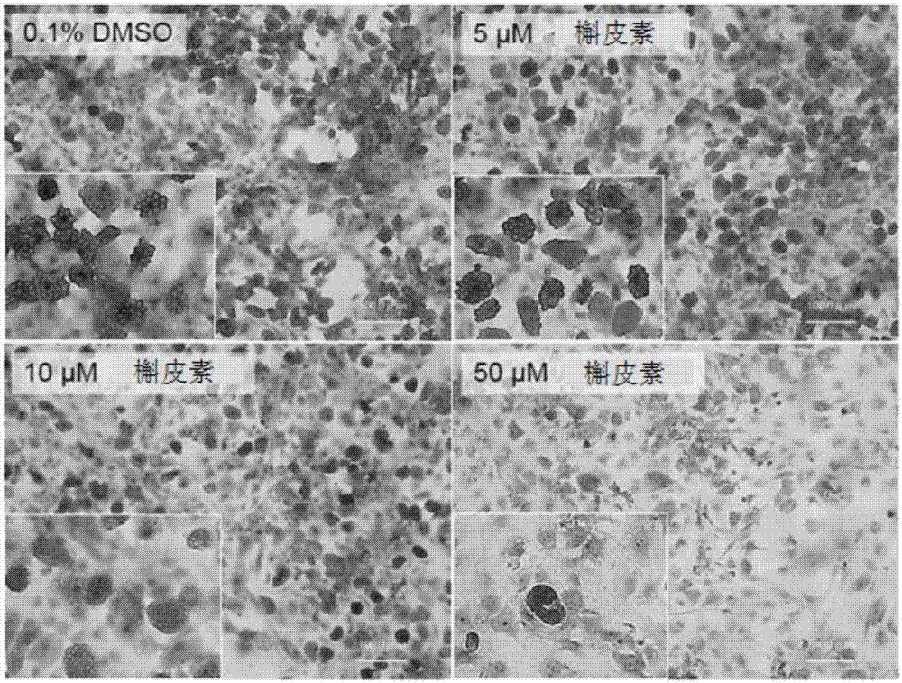 Composition for suppressing muscular fatty change