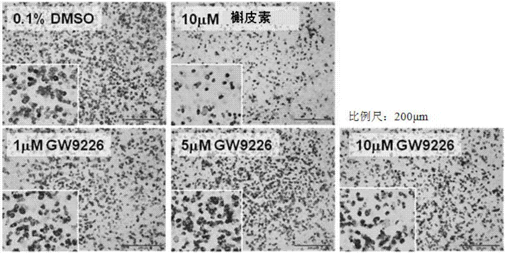 Composition for suppressing muscular fatty change