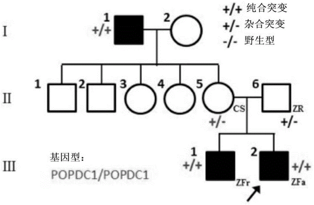 Isolated nucleic acid coding POPDC1 mutant and application thereof