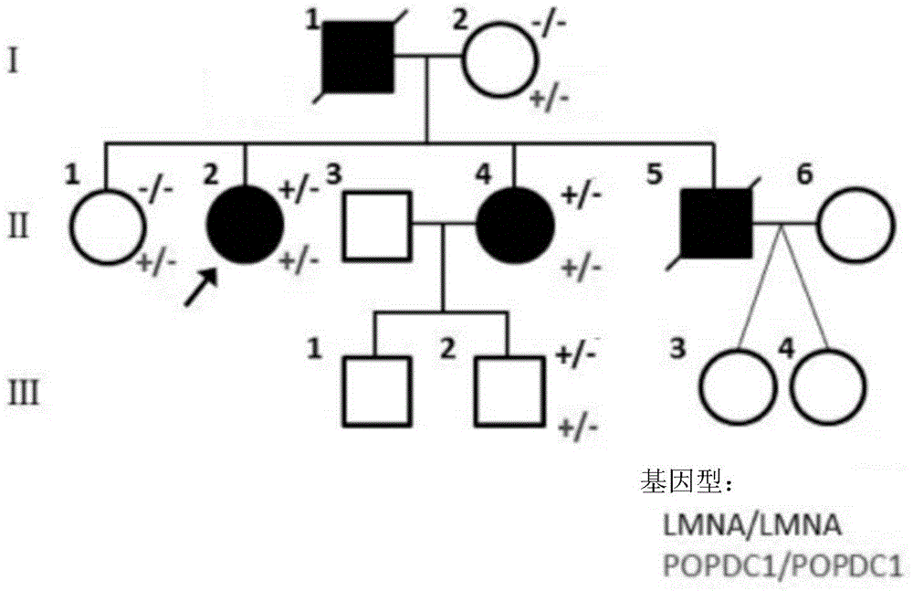 Isolated nucleic acid coding POPDC1 mutant and application thereof