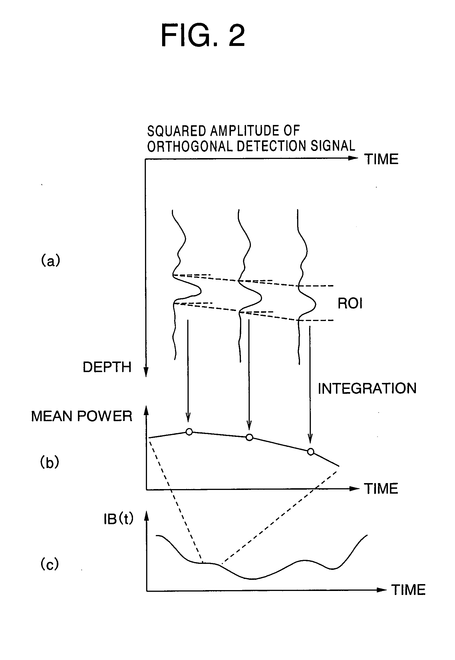 Ultrasonographic system and ultrasonography