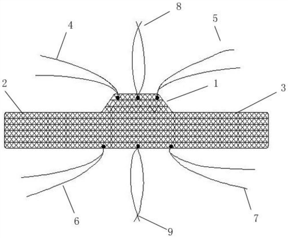 Urethra mesh for female urinary incontinence and moderate pelvic organ prolapse