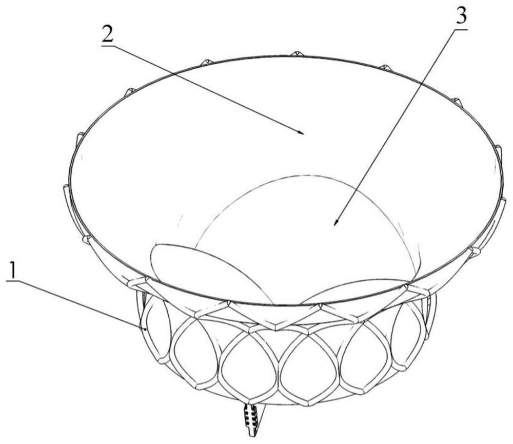 Heart valve prosthesis