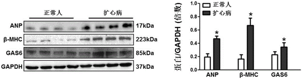 Functions and application of growth arrest-specific proteins 6 (GAS6) to treating myocardial hypertrophy