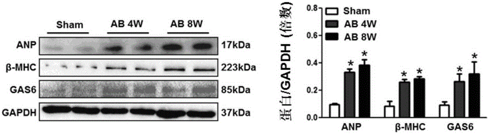 Functions and application of growth arrest-specific proteins 6 (GAS6) to treating myocardial hypertrophy