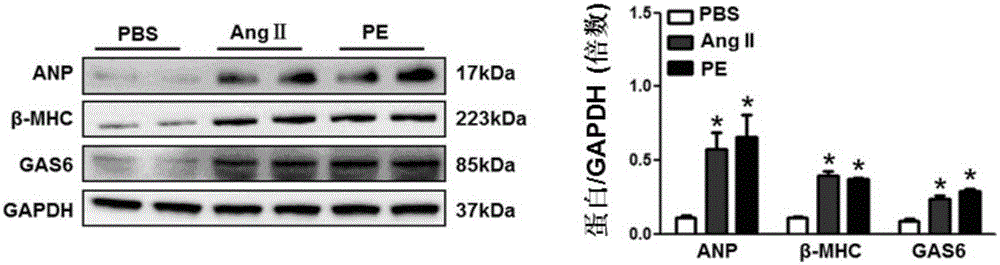 Functions and application of growth arrest-specific proteins 6 (GAS6) to treating myocardial hypertrophy