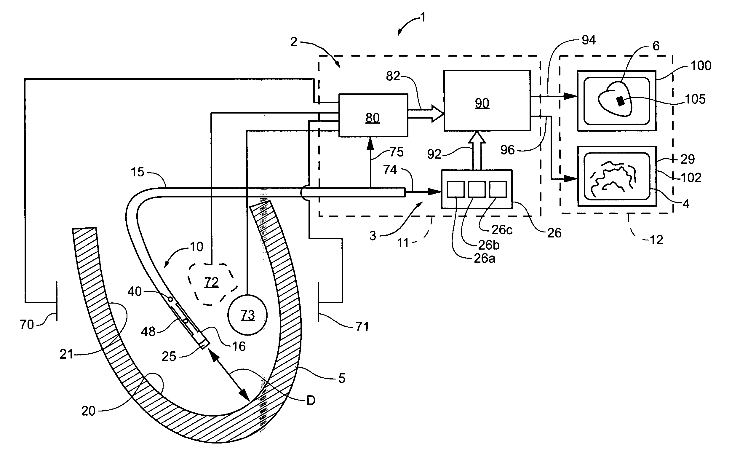 System and method for navigating an ultrasound catheter to image a beating heart