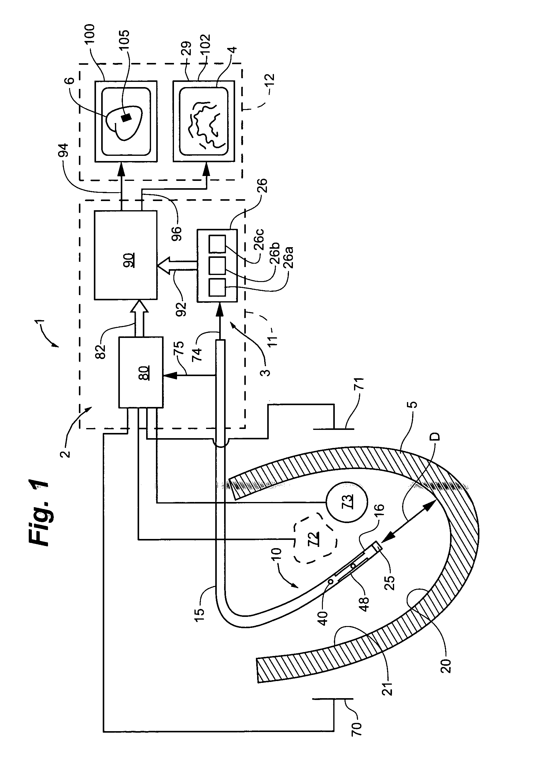 System and method for navigating an ultrasound catheter to image a beating heart