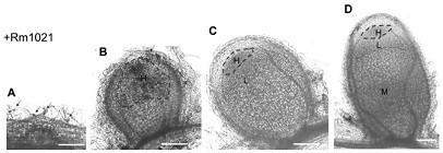 Promoter report gene for detecting superoxide radical ions in nodules and application thereof