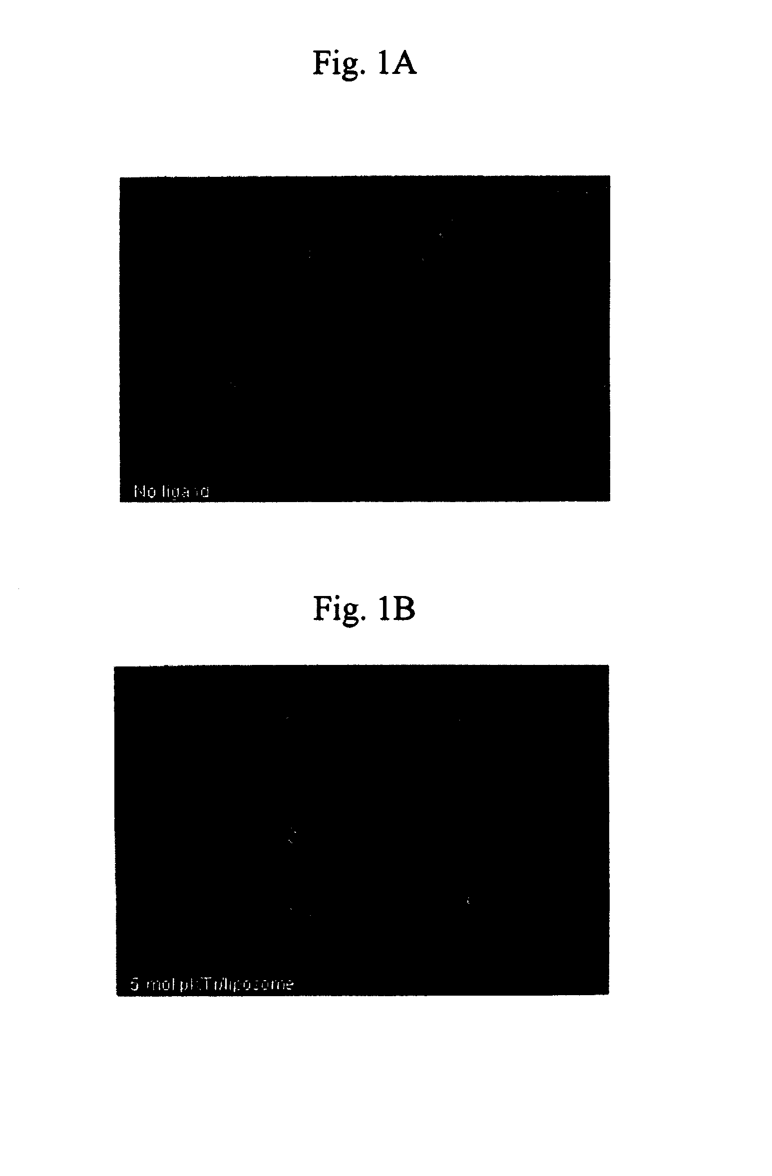 Modular targeted liposomal delivery system