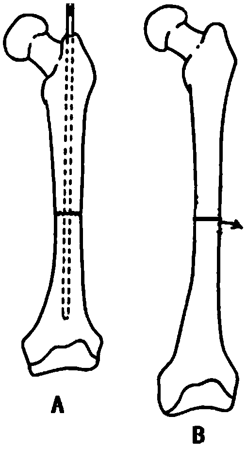 Constructing method and application for osteoportic fracture disease animal model