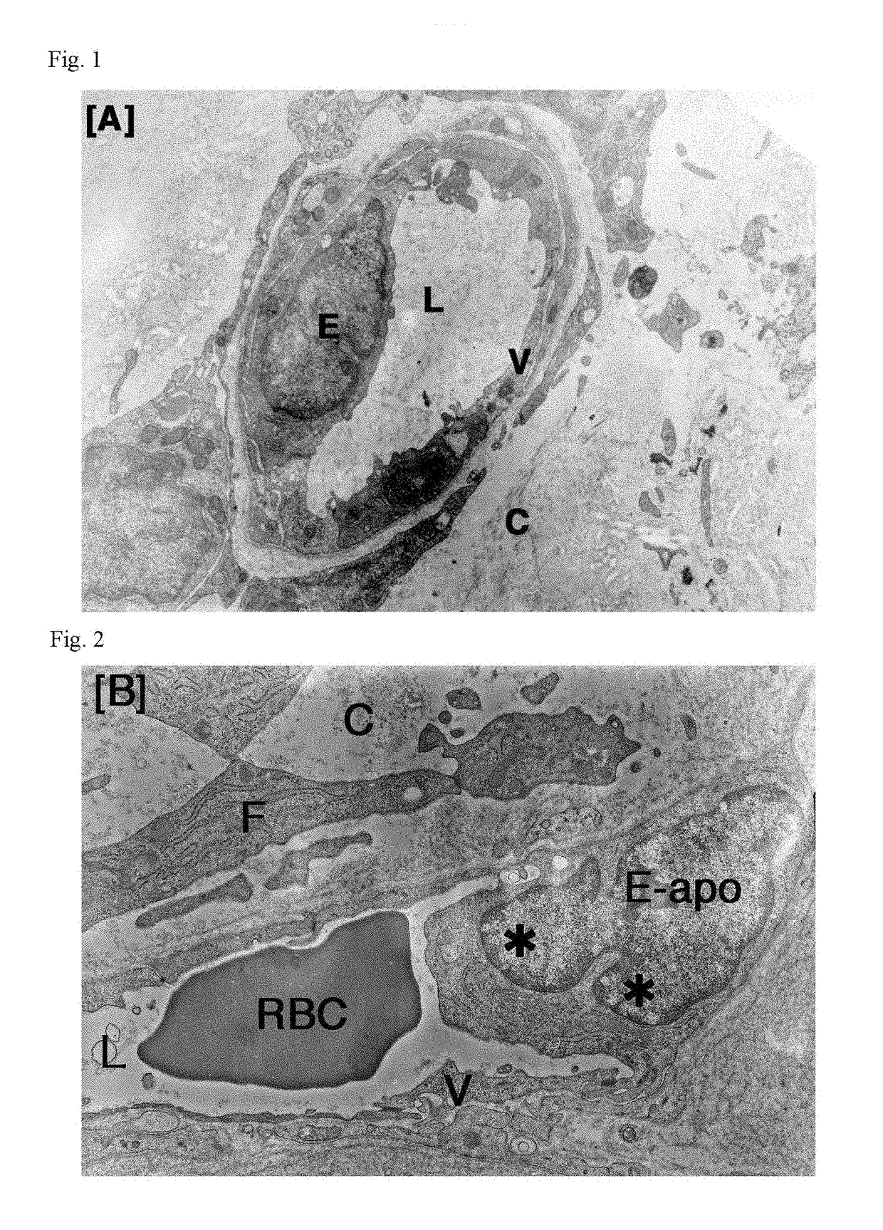 Antitumor agent