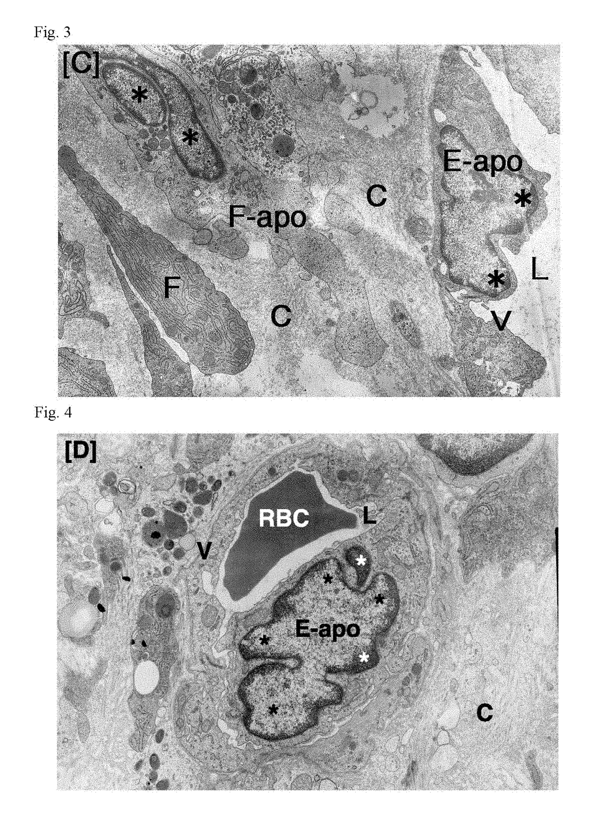 Antitumor agent