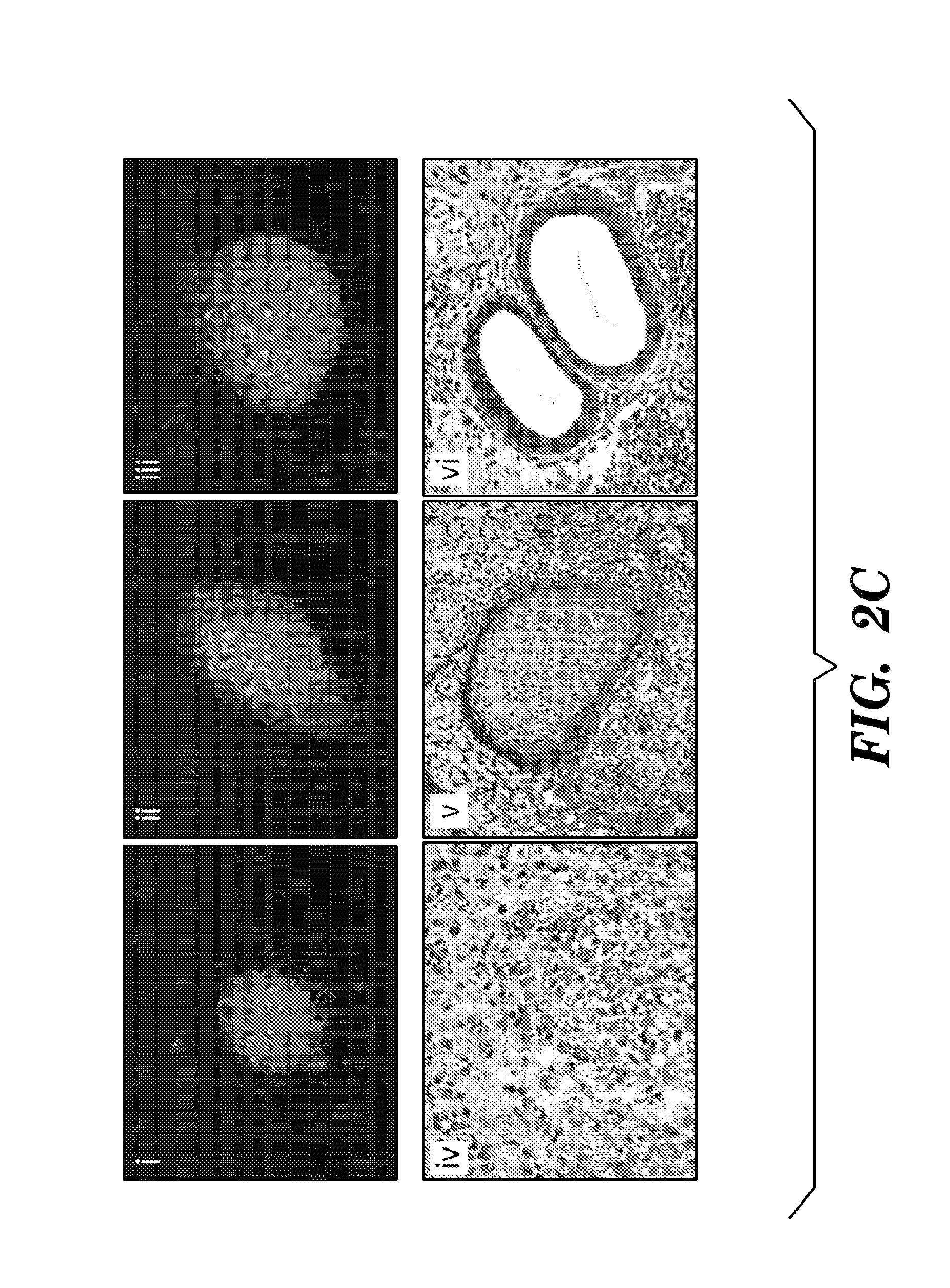 TGF-beta receptor inhibitors to enhance direct reprogramming