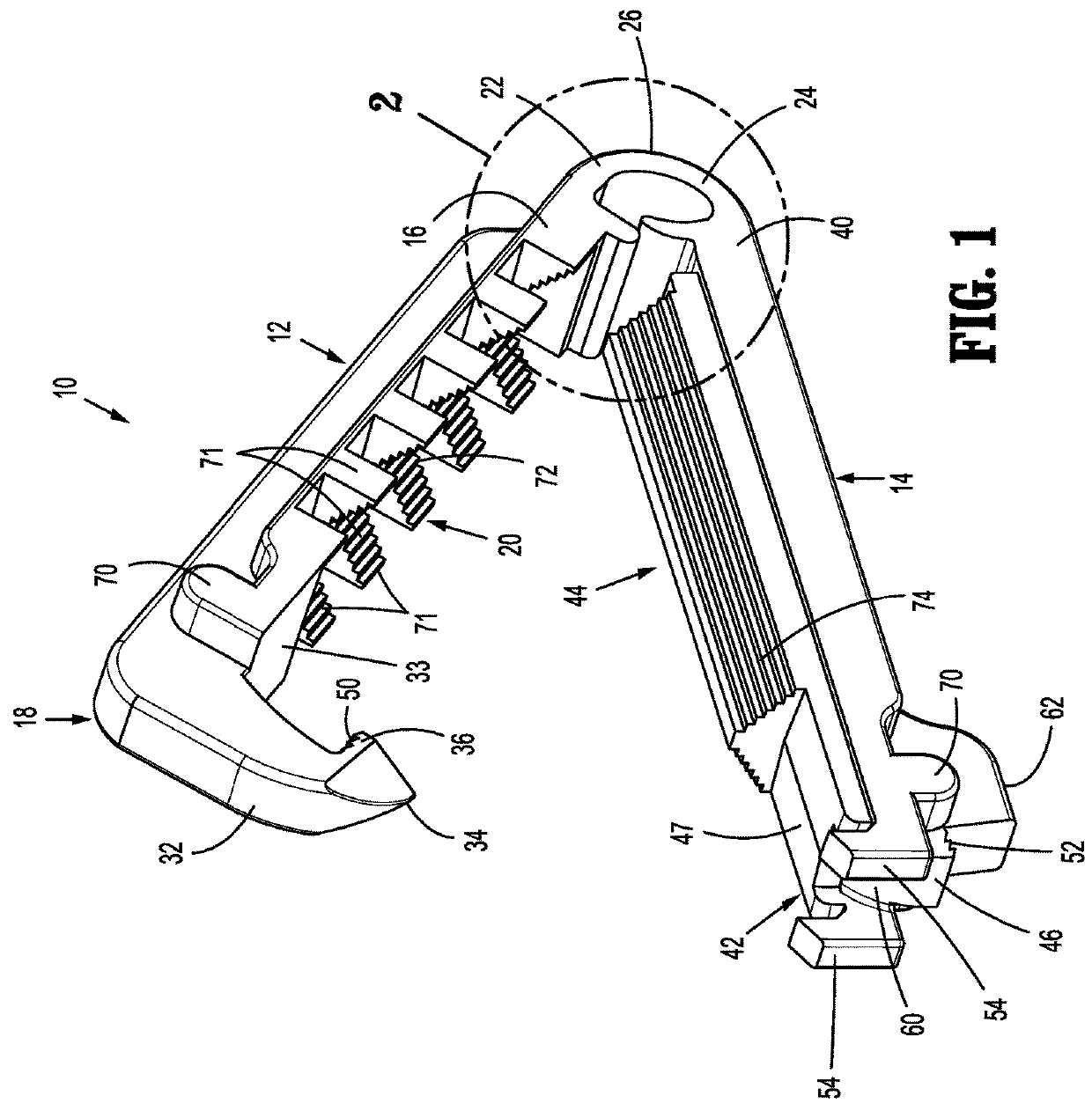 Surgical ligation clip with tissue stop member