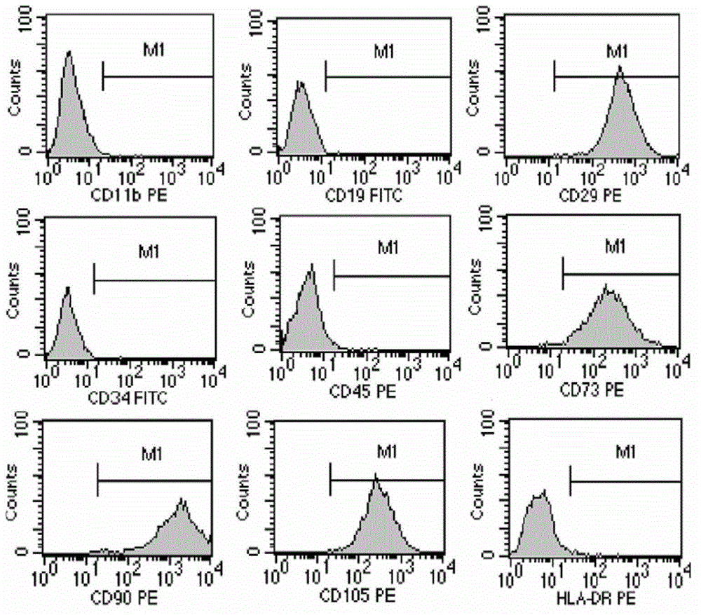 A preparation method of placenta-derived maternal mesenchymal stem cells